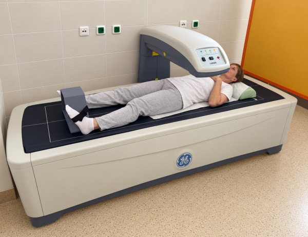 Drastické hubnutí může oslabit kosti na celý život. Osteoporóza ohrožuje i mladé ženy